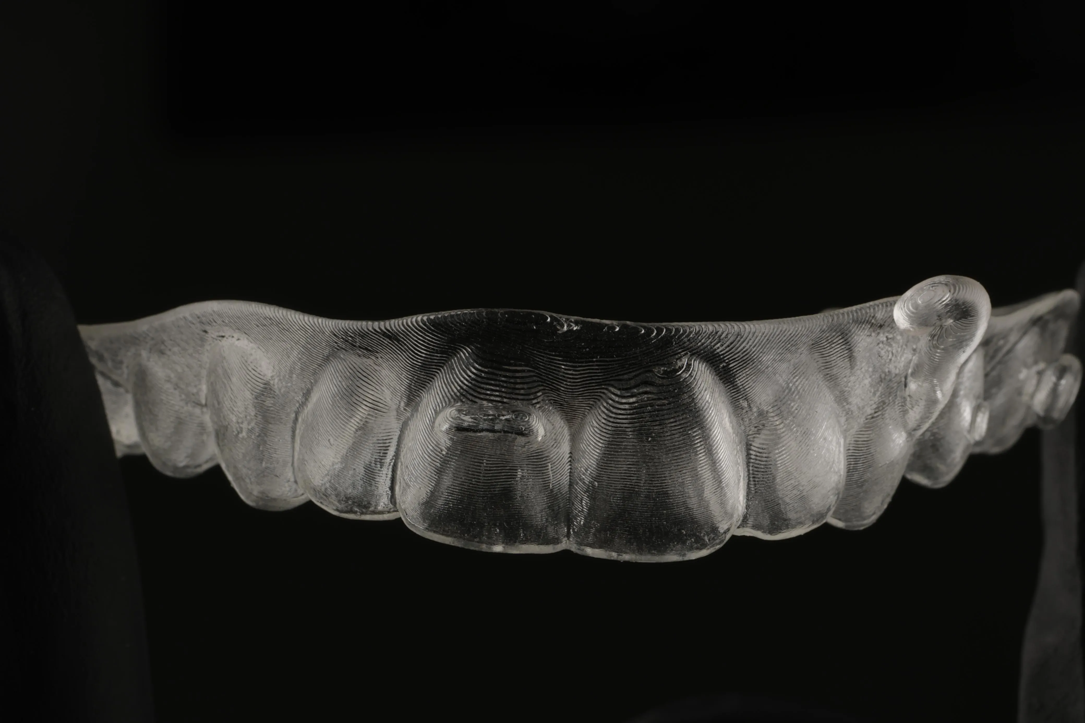 Resultado final de ortodoncia digital con alineadores GO ALIGNER